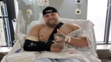 Het seizoen van Strongman Evan Singleton in 2022 is voorbij na een succesvolle bicepsoperatie